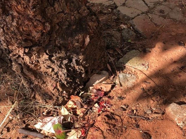 Mulher fica ferida após ser atacada por Pit Bull em Sorriso