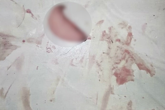 Sorriso: casal discute e homem corta orelha de mulher