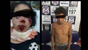 Homem é preso em flagrante após arrancar parte do lábio inferior e do nariz da mulher em MT