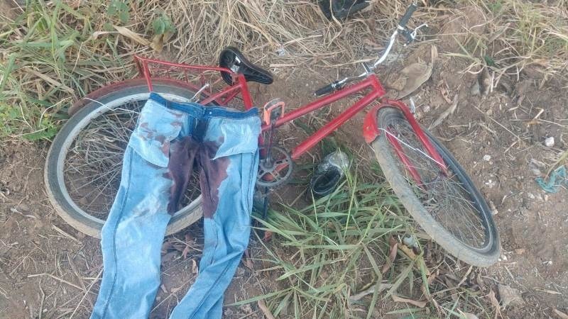 Ladrão se atrapalha e atira na própria perna durante fuga da polícia