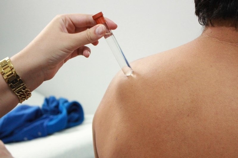 Projeto sinopense é aprovado na 1ª etapa do Prêmio APS Forte para o SUS
