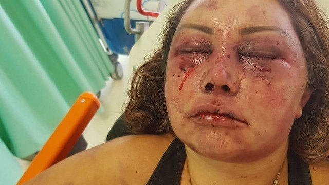 Agressores de mulheres deverão ressarcir custos com atendimento médico