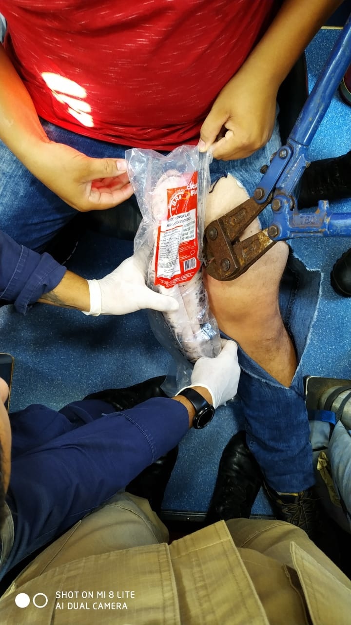 Ferrão de peixe crava na perna de funcionário de supermercado