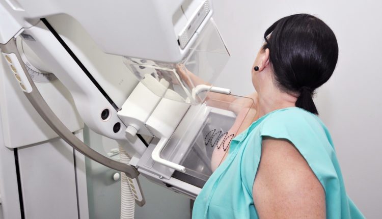 400 mulheres serão contempladas com a mamografia neste mês