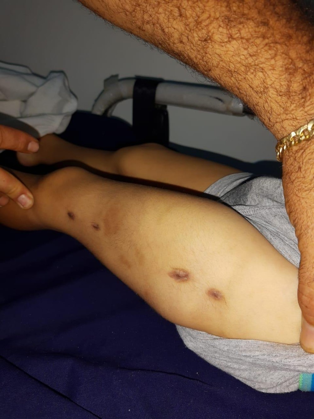 Menino de 3 anos é levado morto para hospital e mãe e namorada são presas