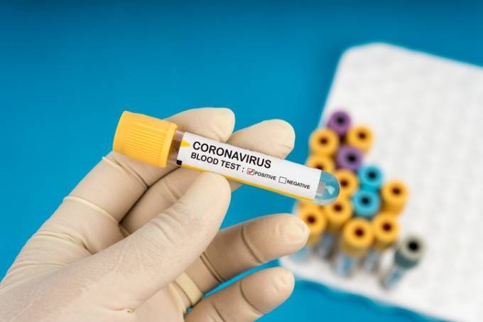 Fiocruz: tendência é de aceleração do espalhamento da Covid-19