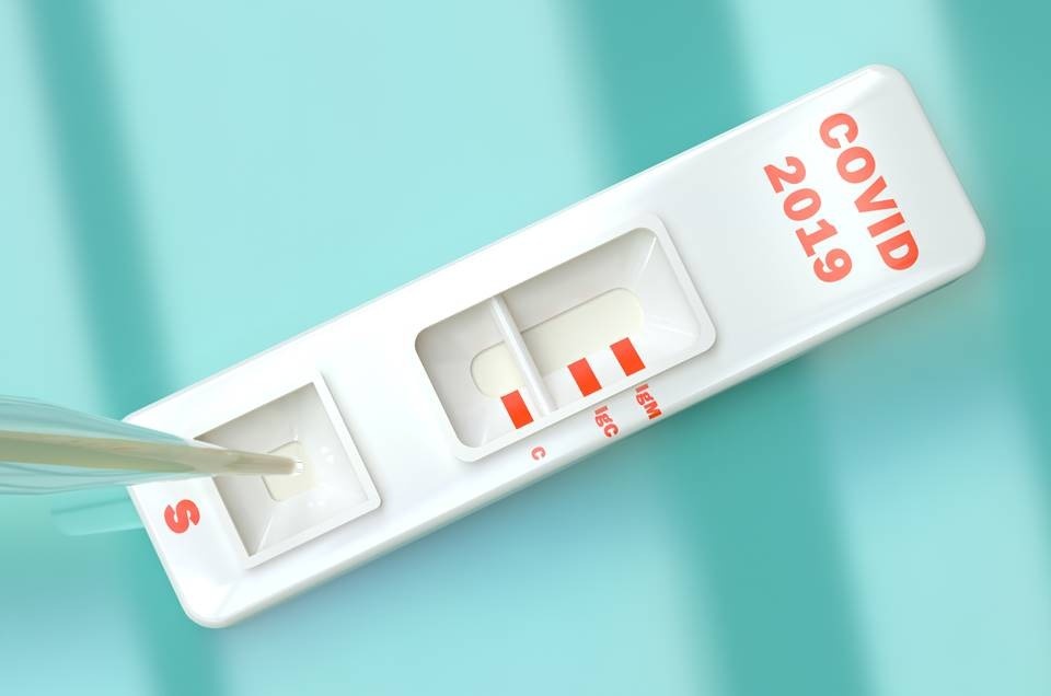 Estado compra teste para Covid por R$ 17,83