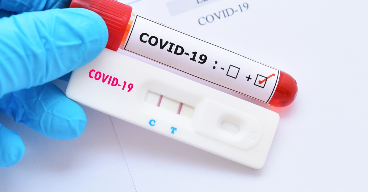 Sinop registra 87 mortes por Covid-19
