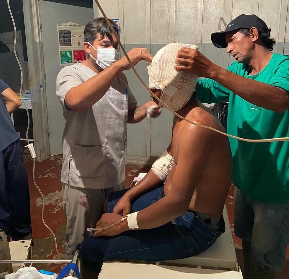 Índio é atacado por onça-pintada e passa por cirurgia em MT