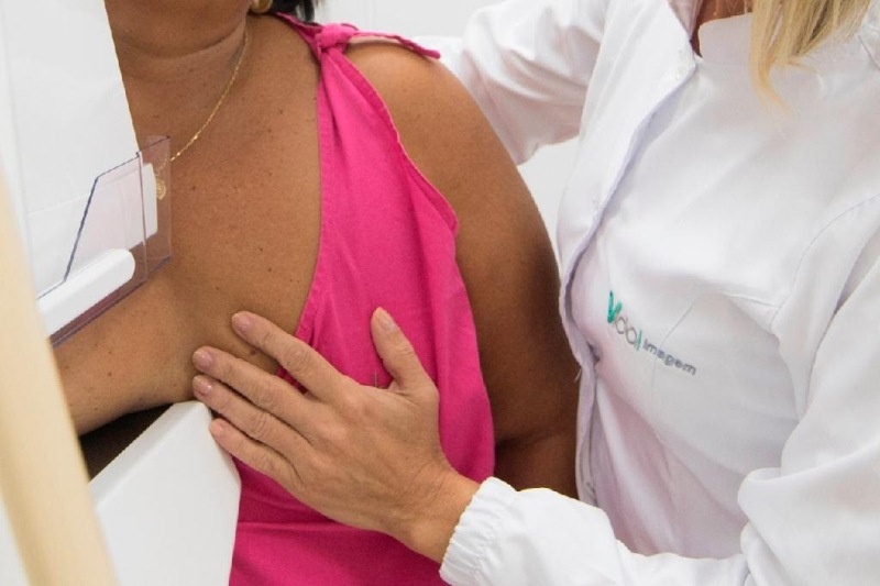Especialistas destacam eficiência da mamografia no diagnóstico precoce do câncer de mama