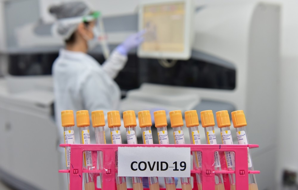 49 casos de reinfecção por Covid-19 são investigados em Mato Grosso