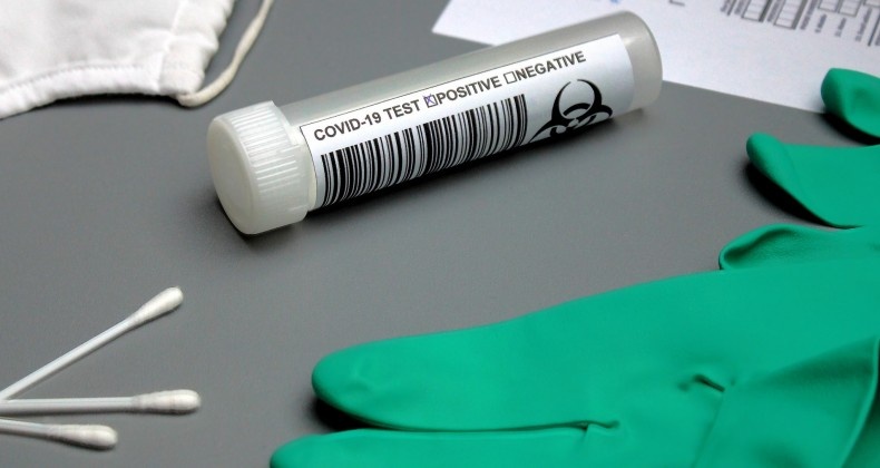 MT tem 24 mortes e 259 novos casos de Covid em 24h