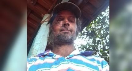 Ciclista sobrevive após ser atropelado duas vezes em menos de 2 minutos; veja vídeo