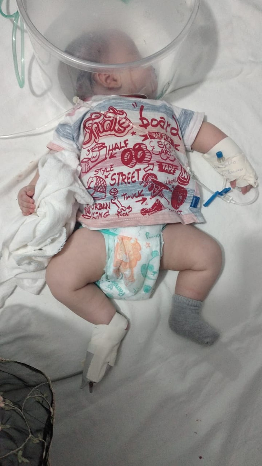 Bebê de 2 meses que teve 90% do pulmão comprometido não resiste à Covid-19