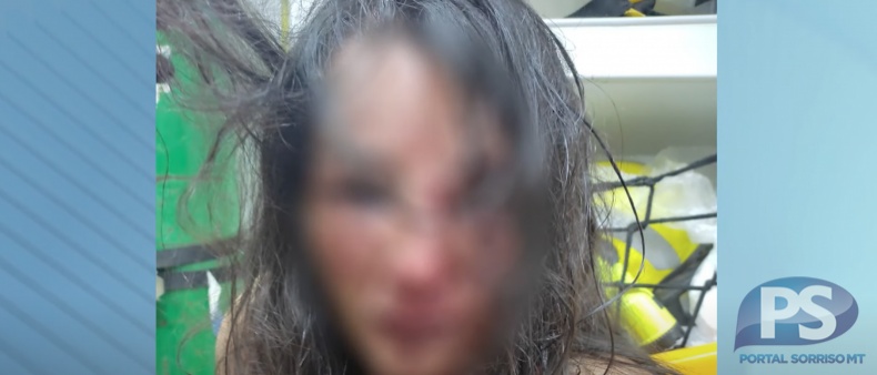 Juiz decreta prisão preventiva de homem que espancou esposa com socos e chutes em Sorriso