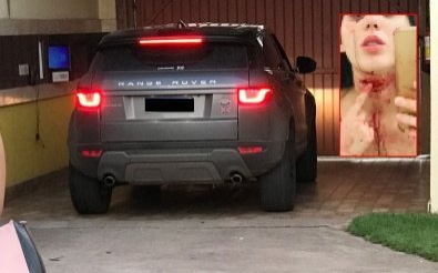 Dançarina que acusa jogadores de agressão recebe alta e deixa MT