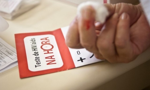Cientistas relatam terceiro caso de possível cura do HIV no mundo