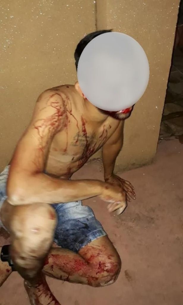 Sinop: Bombeiros resgatam homem baleado em cima de residência
