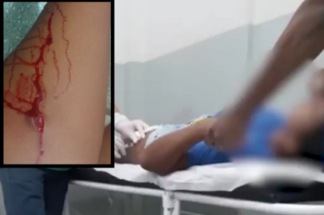 Aluna esfaqueia colega na frente da escola durante briga