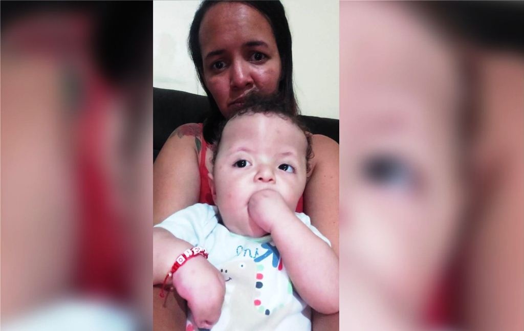 Mãe pede ajuda para que filho consiga passar por cirurgia delicada