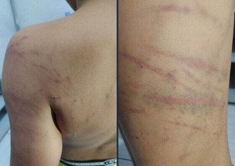 Mulher é detida por espancar filho de 9 anos e liberada após ser ouvida pela polícia