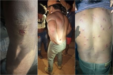 Indígenas são feridos com balas de borracha durante protesto