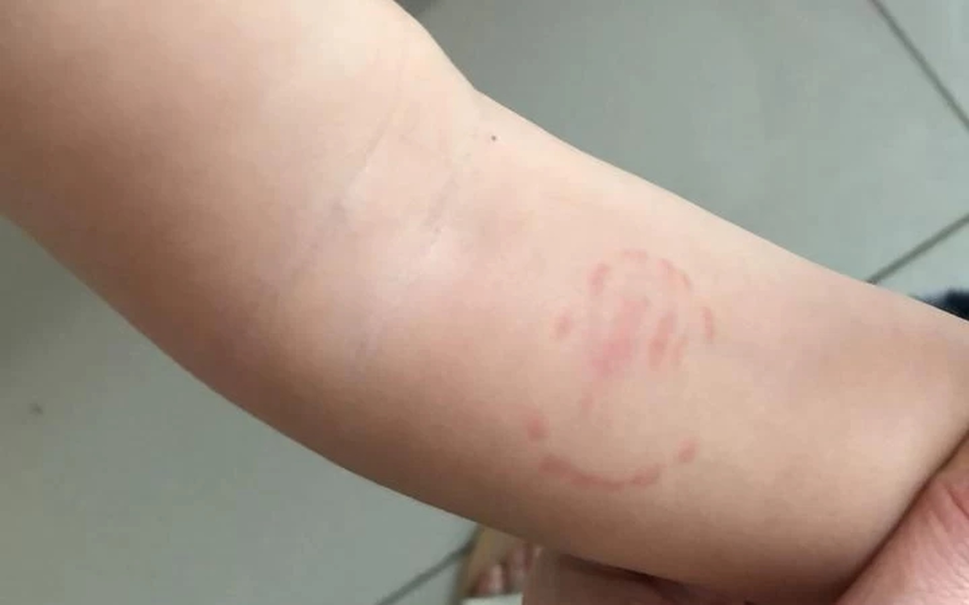 TJ manda Prefeitura de Sinop pagar R$ 15 mil a criança mordida em creche