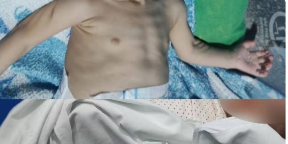 Mãe é presa em MT suspeita de maus-tratos após maquiar rosto de bebê para esconder hematomas: 'Ou come ou apanha'