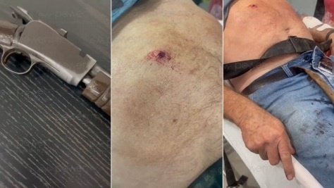 Idoso ferido após disparo acidental de arma de fogo em Nova Mutum