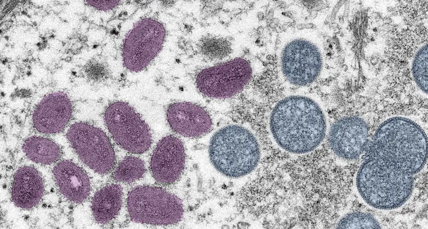 OMS decreta mpox como emergência global; veja como a doença é transmitida e a prevenção