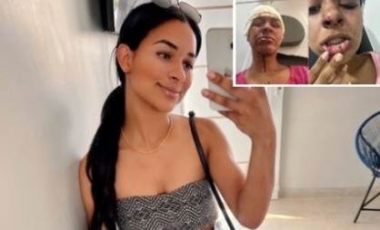 Mulher detalha caso em que homem invadiu casa e tentou estupra-lá em Sorriso