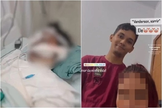 Maníaco ateia fogo na ex-companheira que tem 90% do corpo queimado