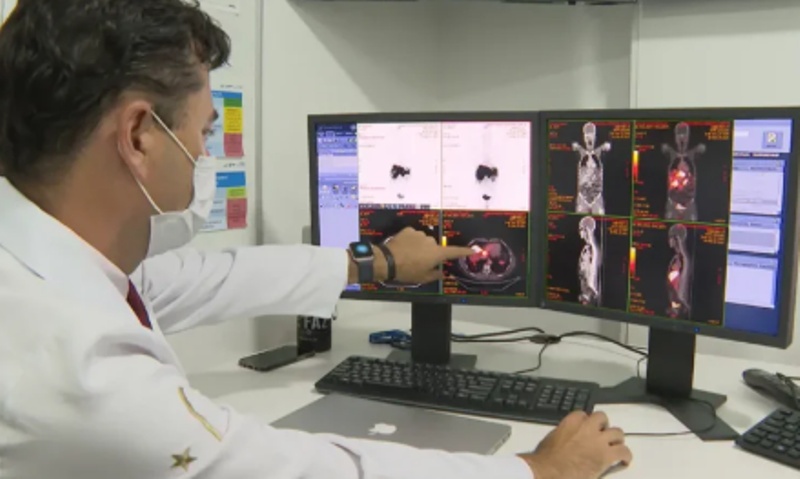Incidência de câncer em MT supera média nacional em vários tipos da doença