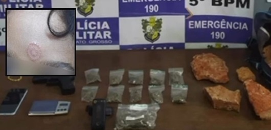 Primo queima rosto de criança com cigarro de maconha para coagir família a cooperar com o tráfico