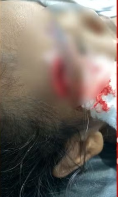 Mãe é presa por maus-tratos após agredir filha de 3 anos com cabo de vassoura em MT