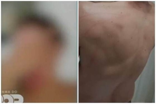 Dona de bar acusa suplente de vereador de agressão em MT