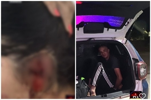 Maníaco arranca orelha de mulher com mordida em MT