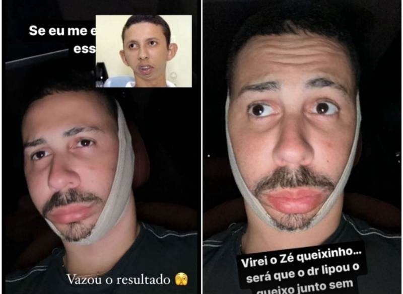 Justiça condena Influencer a indenizar mato-grossense por piada com má formação óssea