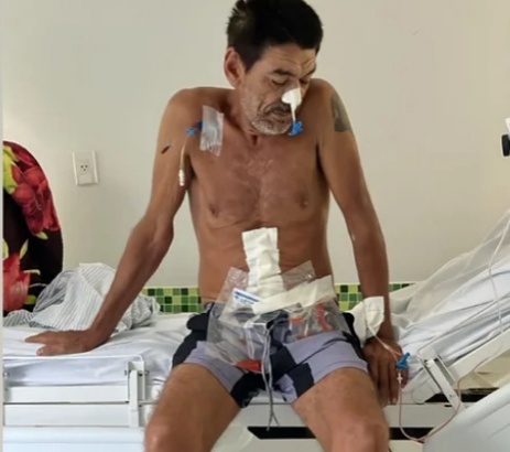 Homem enfrenta grave infecção e família lança campanha para custear tratamento médico