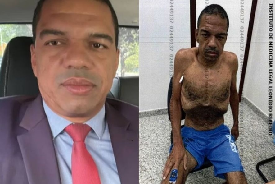 Entenda o que houve com lobista que foi fotografado esquelético