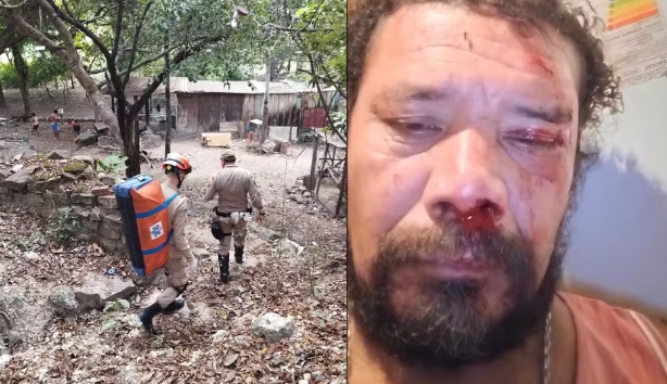 Homem é atacado por onça ao tentar salvar cães no quintal de casa no Pantanal
