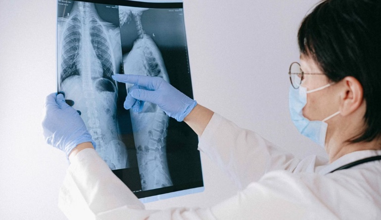 Entenda como é o medicamento brasileiro que pode reverter lesão medular