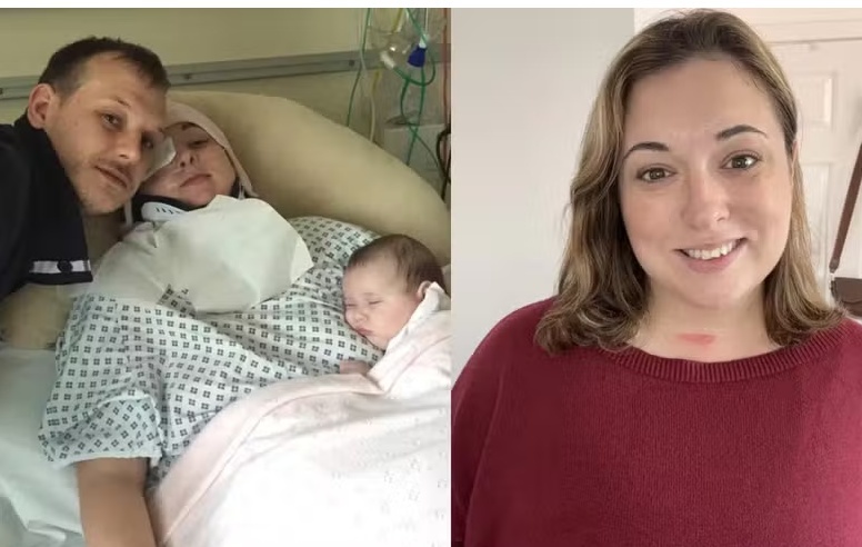 Mulher dá bocejo matinal tão forte que quebra o pescoço: 'Quase morri'