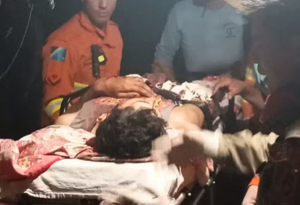 Homem atacado por onça no Pantanal tem alta após cirurgia delicada para retirar garras de felino da perna