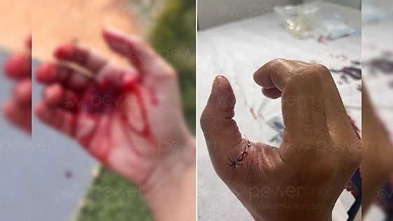 Linha com cerol fere motociclista em Nova Mutum