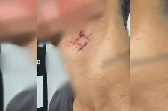 Escravo sexual é resgatado após passar mais de um ano em cárcere