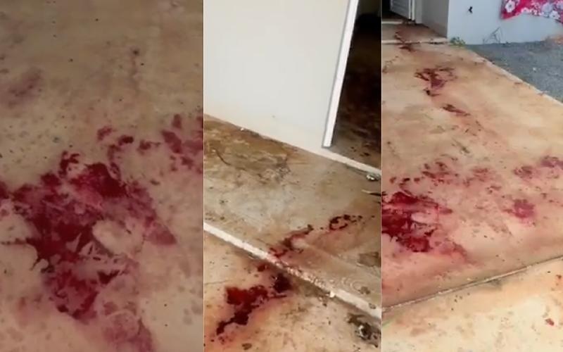 Homem tem braço dilacerado ao quebrar janela da casa da namorada em Sorriso
