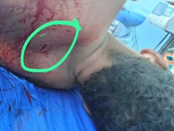 Homem suspeito de estupro coletivo é espancado por populares