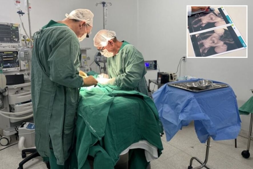 Gêmeos siameses de MT morrem após cirurgia em Goiânia