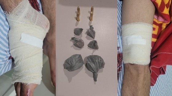 Jovem é baleado e preso após perseguição e troca de tiros com a polícia em MT